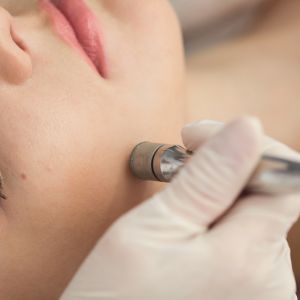 Microdermabrasion Facials